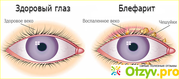 8. Условия отпуска из аптек и цена.