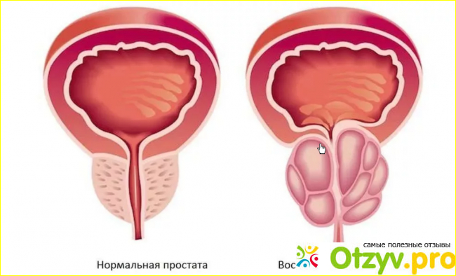 Как принимать препарат?