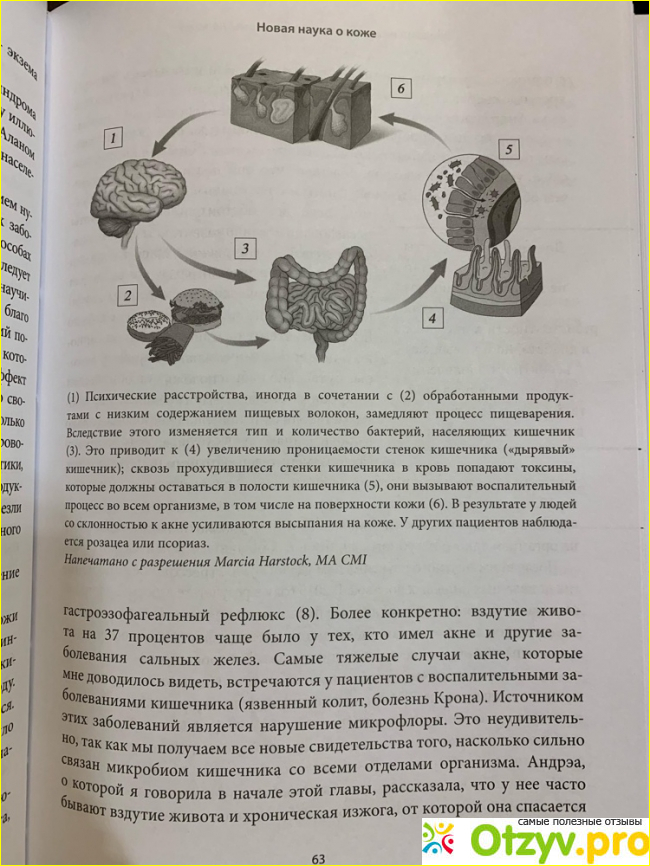 Моя неидеальная кожа. Безупречно ровная, красивая и увлажненная кожа за 3 недели.