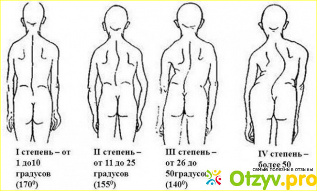 Симптоматика проявления 