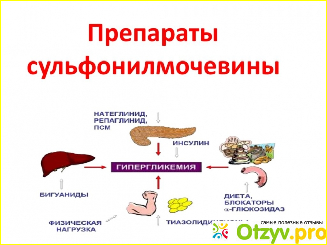 Отзыв о Препараты сульфонилмочевины