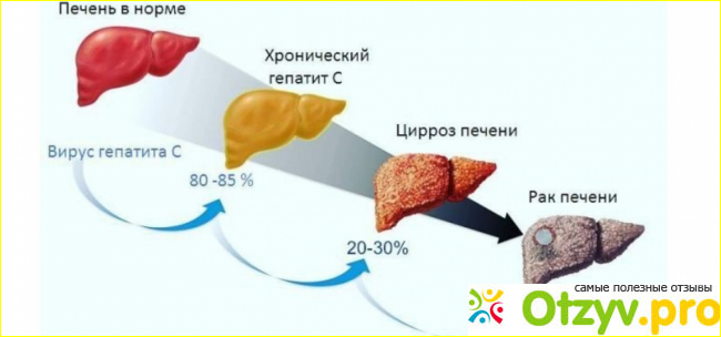 Противопоказания: