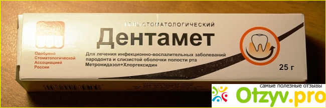 Дентамент