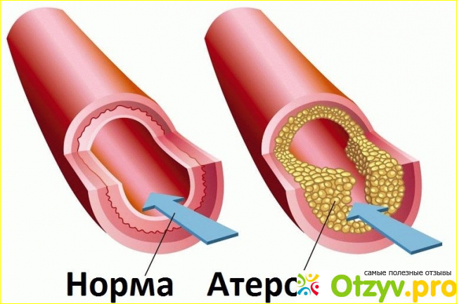 Аналоги и стоимость