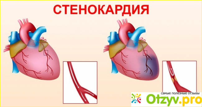 Аналоги и стоимость препарата