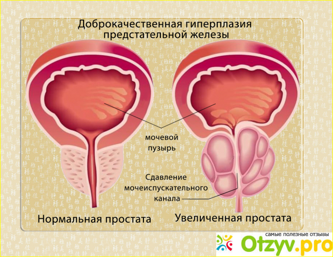 Аналоги и стоимость препарата