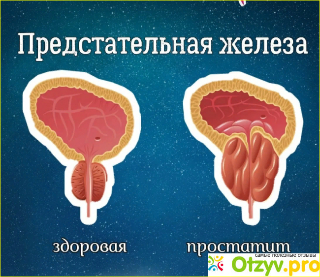 Противопоказания и побочные реакции