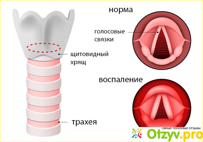 Отзыв о Гомеовокс инструкция по применению цена отзывы