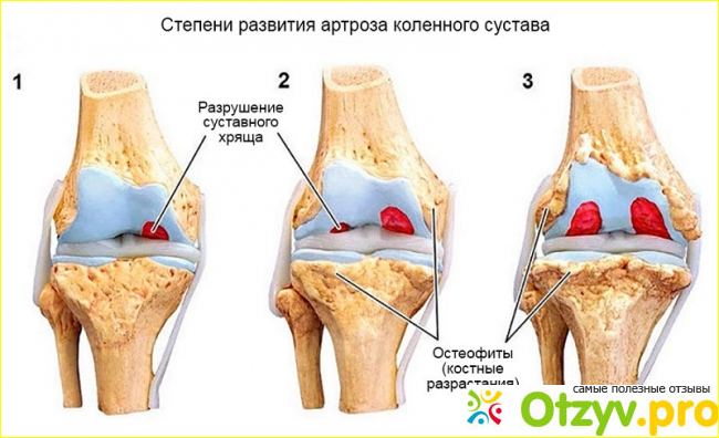  Отзывы покупателей.