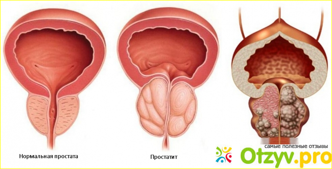  Отзывы пациентов. 