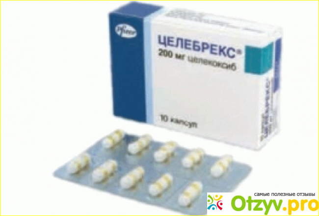 Отзыв о Целебрекс инструкция по применению цена таблетки отзывы