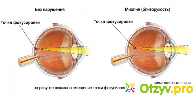 Факторы риска