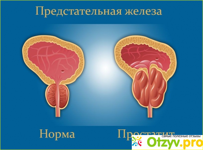 Отзыв о Доктор прост отзывы