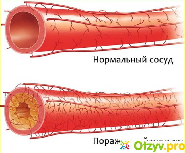 Отзыв о Трайкор