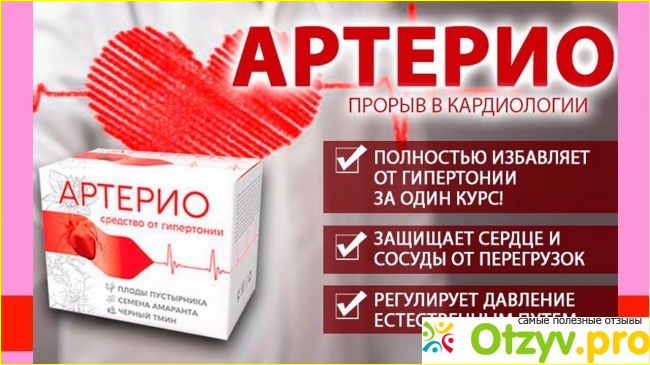 Отзыв о Артерио отзывы