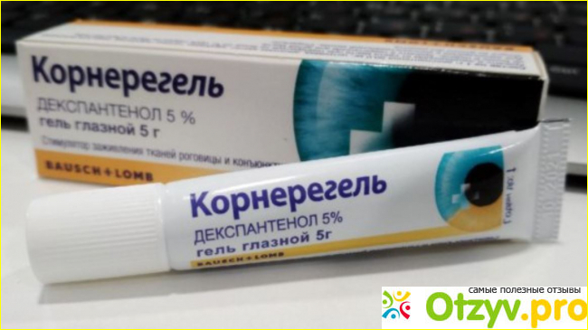 Отзыв о Корнерегель