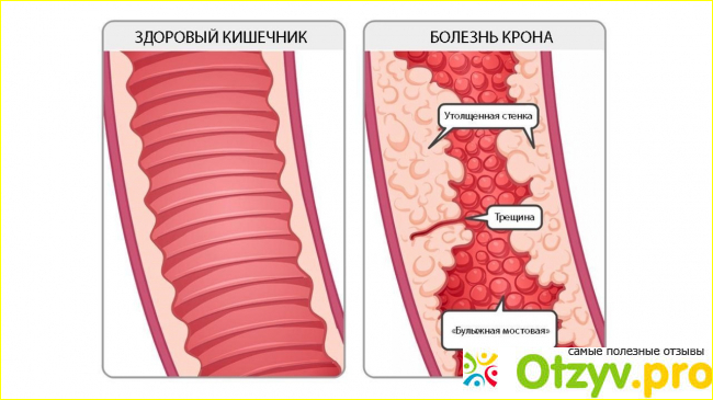 Отзыв о Буденофальк