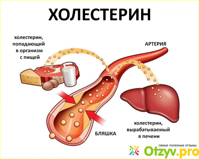 Отзыв о Сувардио