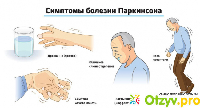Отзыв о Юмекс