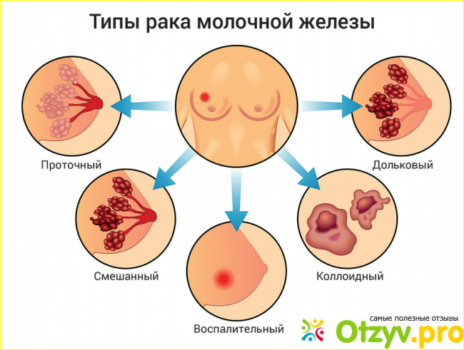 Отзыв о Селана