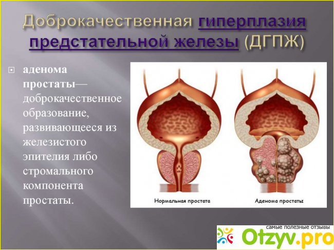 Отзыв о Простагут