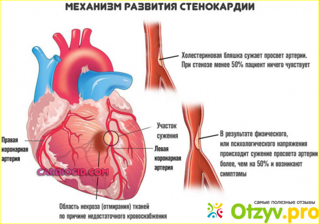 Отзыв о Перлинганит