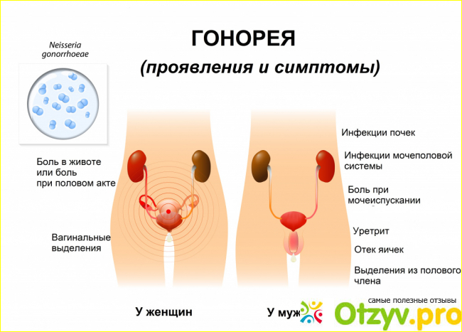 Отзыв о Кирин