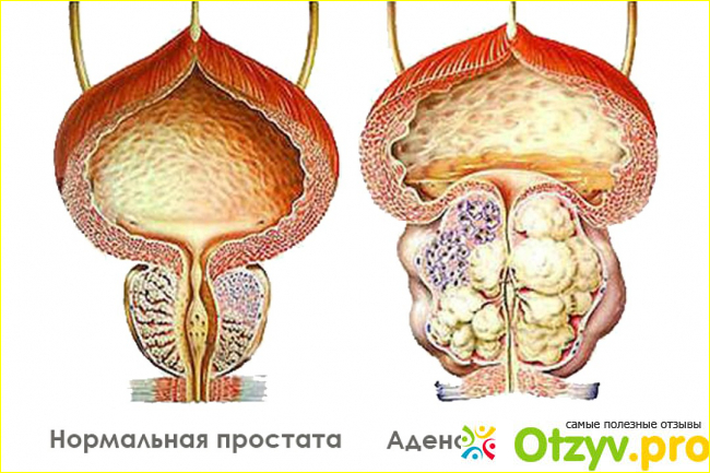  История лечения. 