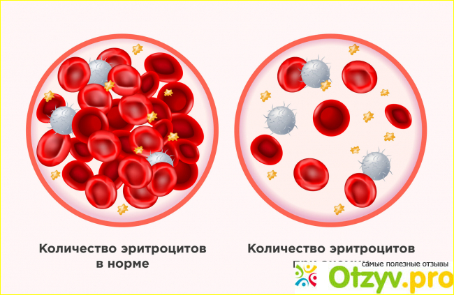 Отзыв о Эпоэтин бета