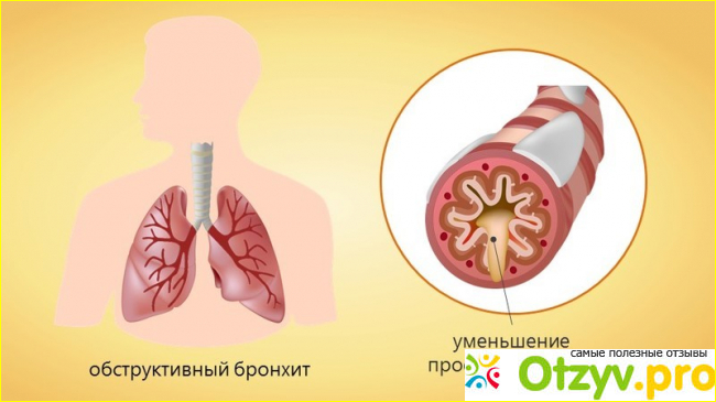Опыт применения. 