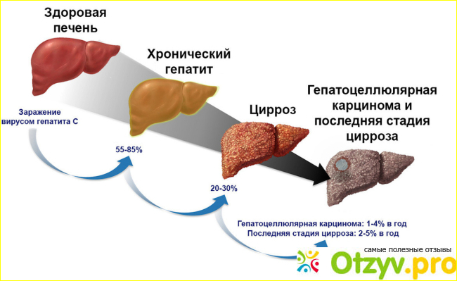 Отзыв о Даклатасвир