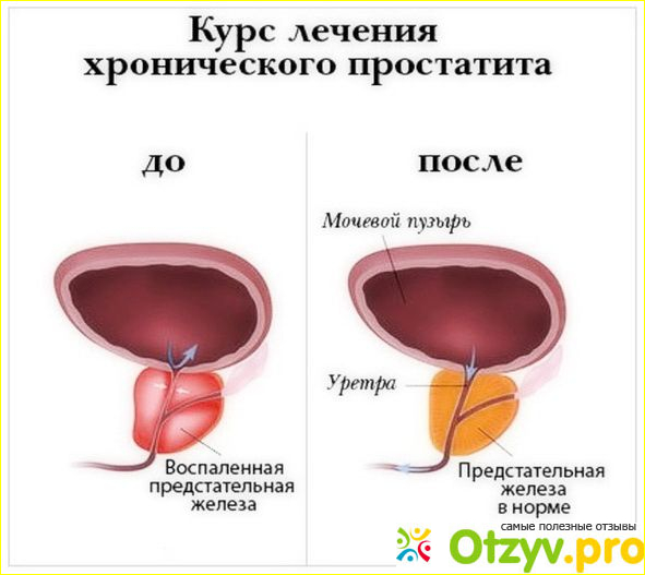  Отзывы пациентов. </p><p>