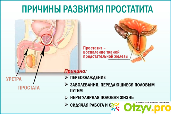 Отзыв о Аденоформ