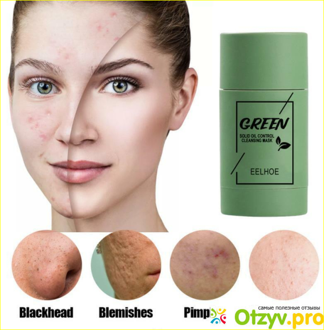 Green Acne Stick отзывы