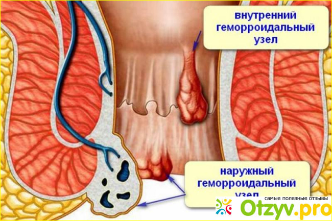 Результат применения. 