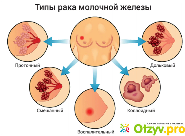 Отзыв о Анастразол BD Anastrozole