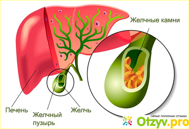 Отзыв о Урсактив Лекарство