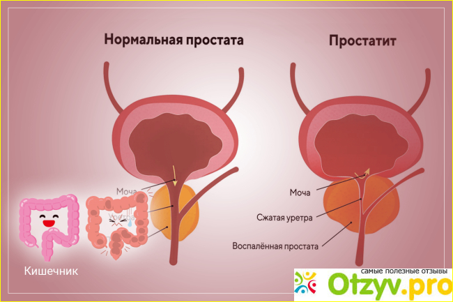 Отзыв о Урокард таблетки отзывы врачей