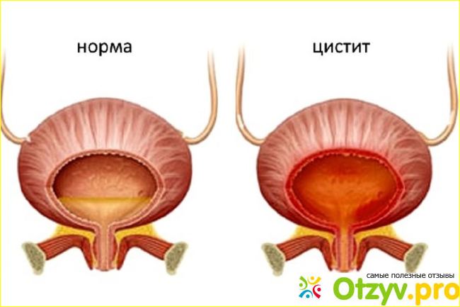 Отзыв о Манорен таблетки шипучие отзывы