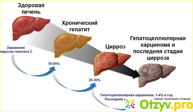 Отзыв о Глатион лиофилизат для приготовления раствора для инъекций отзывы