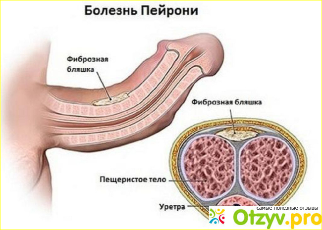 Комплектация