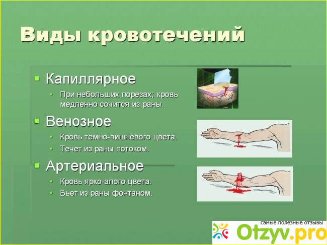 Схема остановки кровотечения регулоном. Дюфастон остановил кровотечение схема. Регулон при кровотечении схема.