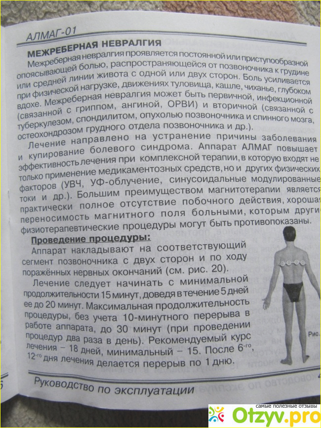 Алмаг 01 противопоказания отзывы. Алмаг инструкция. Алмаг-01 инструкция по применению с картинками. Алмаг-1 инструкция по применению. Как пользоваться алмаг 1.