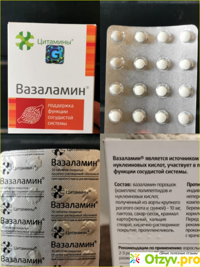Вазаламин таблетки отзывы врачей и пациентов. Вазаламин таблетки. Взалходин таблетки. Вазаламин фото. Вазаламин аналоги.